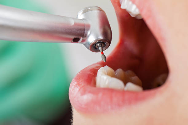 Best Emergency Tooth Extraction  in Moriarty, NM